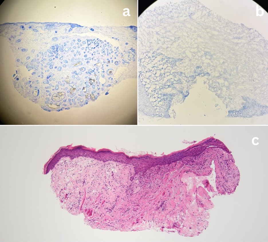 Pathology image